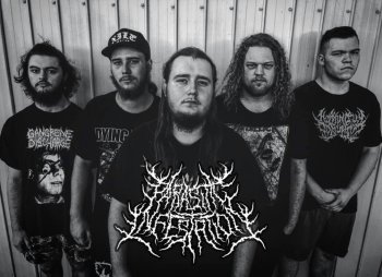 Parasitic Infestation