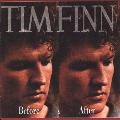 Tim Finn Before & After